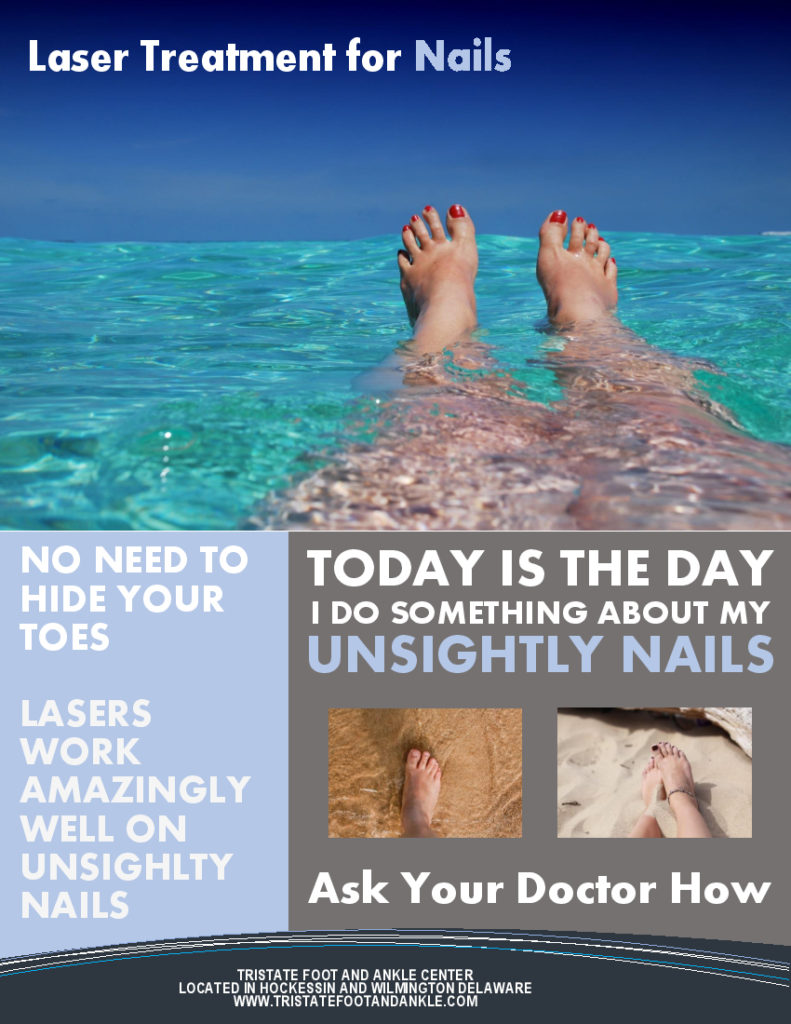 Unsightly Nails Laser Therapy from Tristate Foot and Ankle
